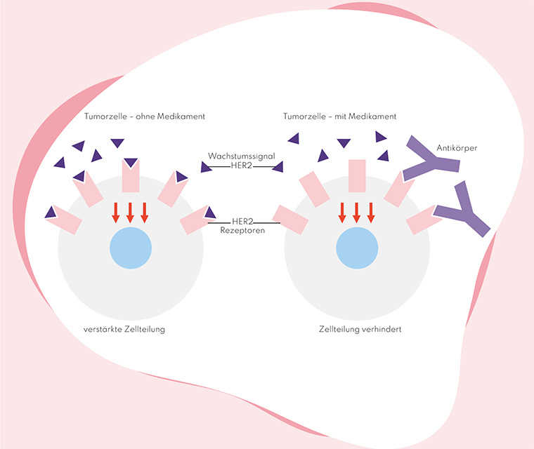 Zielgerichtete Therapie | Leben Mit Brustkrebs